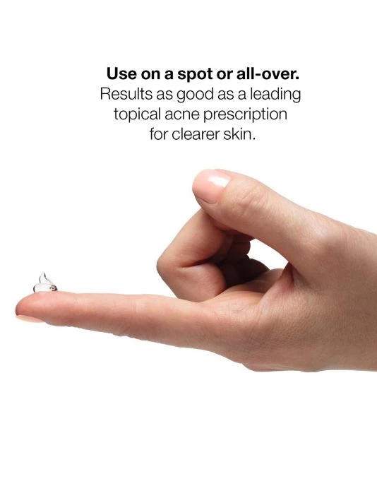 Clinique Acne Solutions™ Clinical Clearing Gel 3 Clinique Acne Solutions™ Clinical Clearing Gel - Image 2