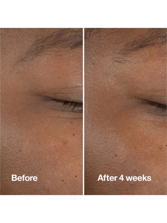 Clinique Clarifying Do-Over Peel 10 Clinique Clarifying Do-Over Peel - Image 8