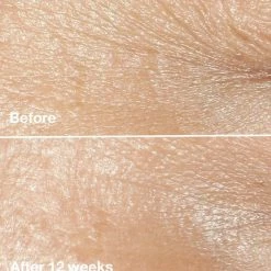 Clinique Smart Clinical Repair™ Wrinkle Correcting Cream -Clinique Sales Shop unnamed file 327